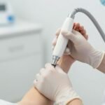 Traitement miraDry de l'hyperhidrose axillaire avec applicateur médical