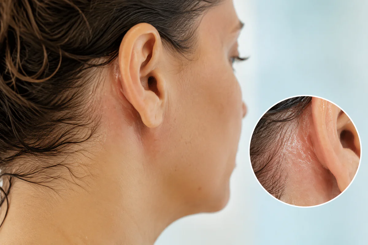 Mauvaise odeur derrière les oreilles peut cacher une irritation